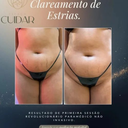 espacocuidar_bronze_564551975_17986369613904882_7298087411779350106_n